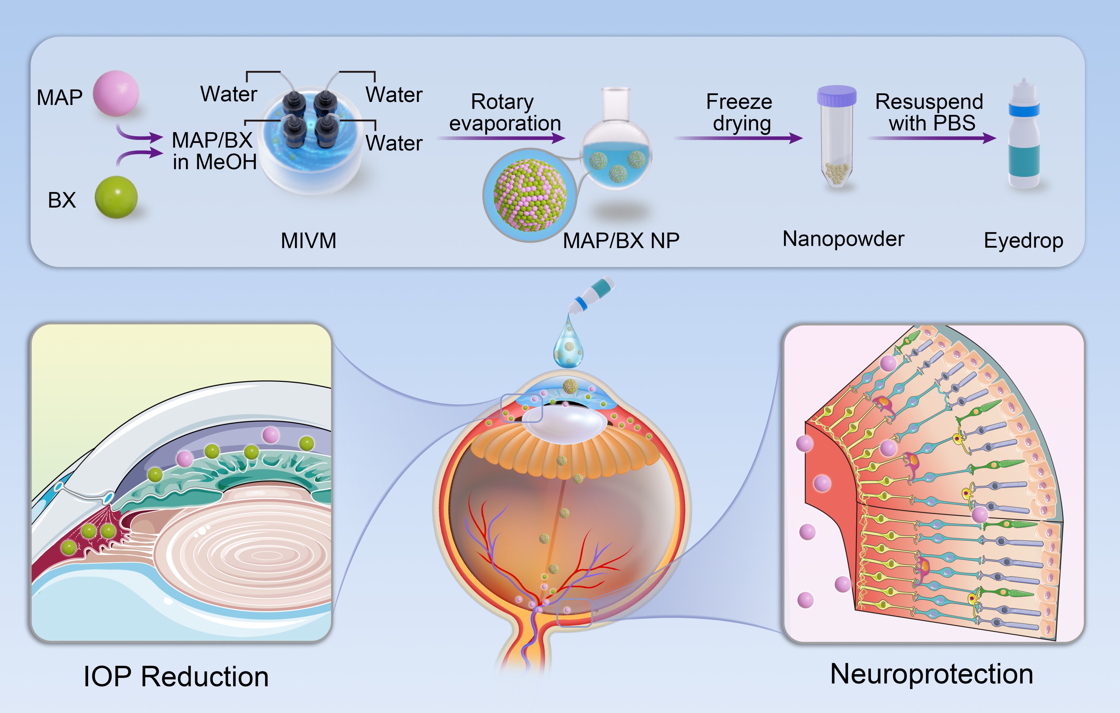 Diagram showing a nanomedicine process for eye treatment. Top outlines steps: mixing, rotary evaporation, freeze-drying, and resuspension. Bottom displays a cross-section of an eye with two diagrams: IOP reduction and neuroprotection effects from the medicine.
